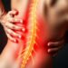 Understanding the Top Sciatica Causes and How to Relieve Pain