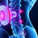 Lumbar Disc: Causes, Symptoms, and Effective Treatment Options