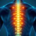 Lumbar Disc Herniation Symptoms and Treatment Options Explained