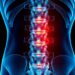 Understanding Lumbar Instability: Symptoms, Causes, and Effective Treatments