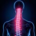 Nerve Root Pain: Causes, Symptoms, and Effective Treatment Options