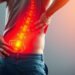 Effective Sciatica Diagnosis: Key Signs and When to Seek Help