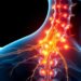 Understanding Lumbar Nerve Roots: Key Causes and Effective Treatments