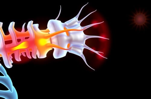 Nerve Root Compression Causes, Symptoms, and Effective Treatment Options