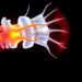 Nerve Root Compression Causes, Symptoms, and Effective Treatment Options