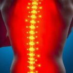 Effective Sciatic Nerve Pain Relief Techniques for Lasting Comfort