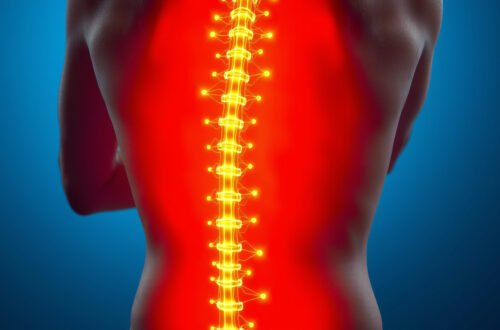 Effective Sciatic Nerve Pain Relief Techniques for Lasting Comfort
