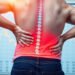 Managing a Sciatica Flare-Up: Effective Tips for Quick Relief