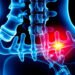Herniated Disc Symptoms and Treatment Options You Need to Know