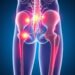Sciatic Nerve Compression: Causes, Symptoms, and Effective Treatments Explained