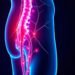 Sciatica Diagnosis: Key Symptoms, Tests, and Treatment Options Explained