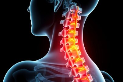 Spinal Stenosis: Causes, Symptoms, and Effective Treatment Options Explained