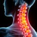 Spinal Stenosis: Causes, Symptoms, and Effective Treatment Options Explained