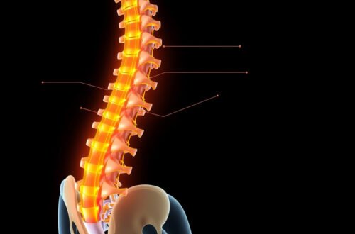 Top Sciatic Nerve Pain Causes and How to Effectively Relieve Them