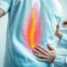 Sciatica Diagnosis: Key Steps to Identify and Treat Your Pain Quickly