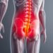 Sciatica Inflammation: Causes, Symptoms, and Effective Relief Methods