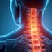 Spinal Nerve Compression: Causes, Symptoms, and Effective Treatments Explained