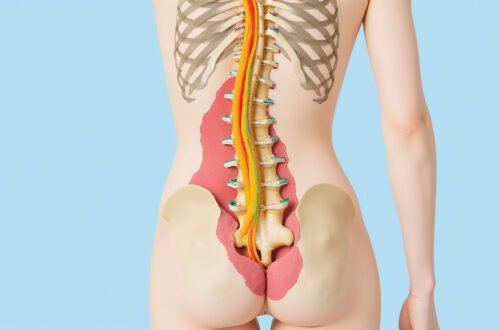 cauda equina syndrome: Early Symptoms and Urgent Treatment Steps