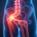 femoral nerve pain? Top treatments, diagnosis, and recovery tips