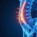 lumbar MRI: What Your Scan Really Reveals About Back Pain