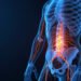 lumbosacral plexus Pain Explained: Diagnosis, Treatment, and Prevention