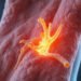 nerve tethering: Symptoms, Causes, and Breakthrough Treatments to Try