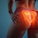 trochanteric bursitis: 7 Proven Ways to Stop Hip Pain Fast