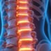 facet arthropathy: Everyday Causes, Hidden Symptoms, and Fast Relief