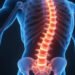Multifidus Muscle Secrets: Strengthen Your Spine and End Pain