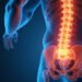 Neurogenic Sciatica Relief: Proven Treatments to End Nerve Pain