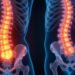Nucleus pulposus: Secrets Every Back Pain Sufferer Should Know