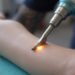 Graston technique Guide: How to Heal Faster and Reduce Pain