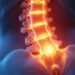 S1 radiculopathy: Top Symptoms, Causes, and Rapid Relief Strategies